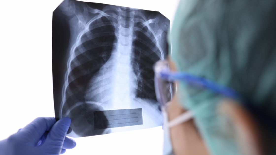 Expert Chiropractic Services on the Gold Coast: Your Path to Pain-Free Living - Image 2